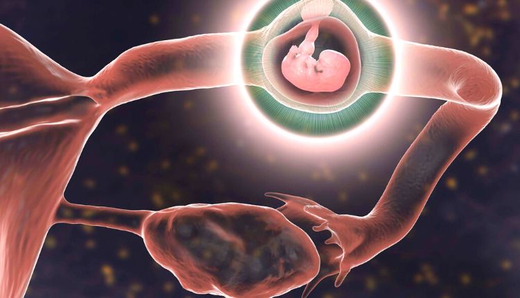 طفل ينمو داخل قناة فالوب كما يحدث في الحمل خارج الرحم 