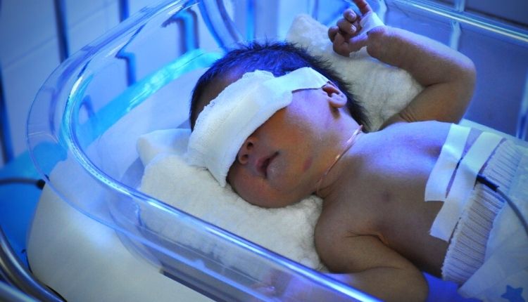 طفل يعالج من اليرقان عند حديثي الولادة بالضوء 
