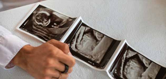 الجنين في اسبوع الحمل السابع والعشرين؛ ثلاث صور لأجنة بجانبها يد سيدة على قماش أبيض